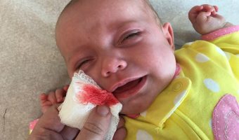 PEDIATRIC OFFICE VISIT ENDS IN BLOODSHED